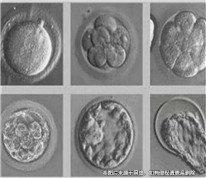 男方私自放棄冷凍胚胎，被判賠償妻子3萬